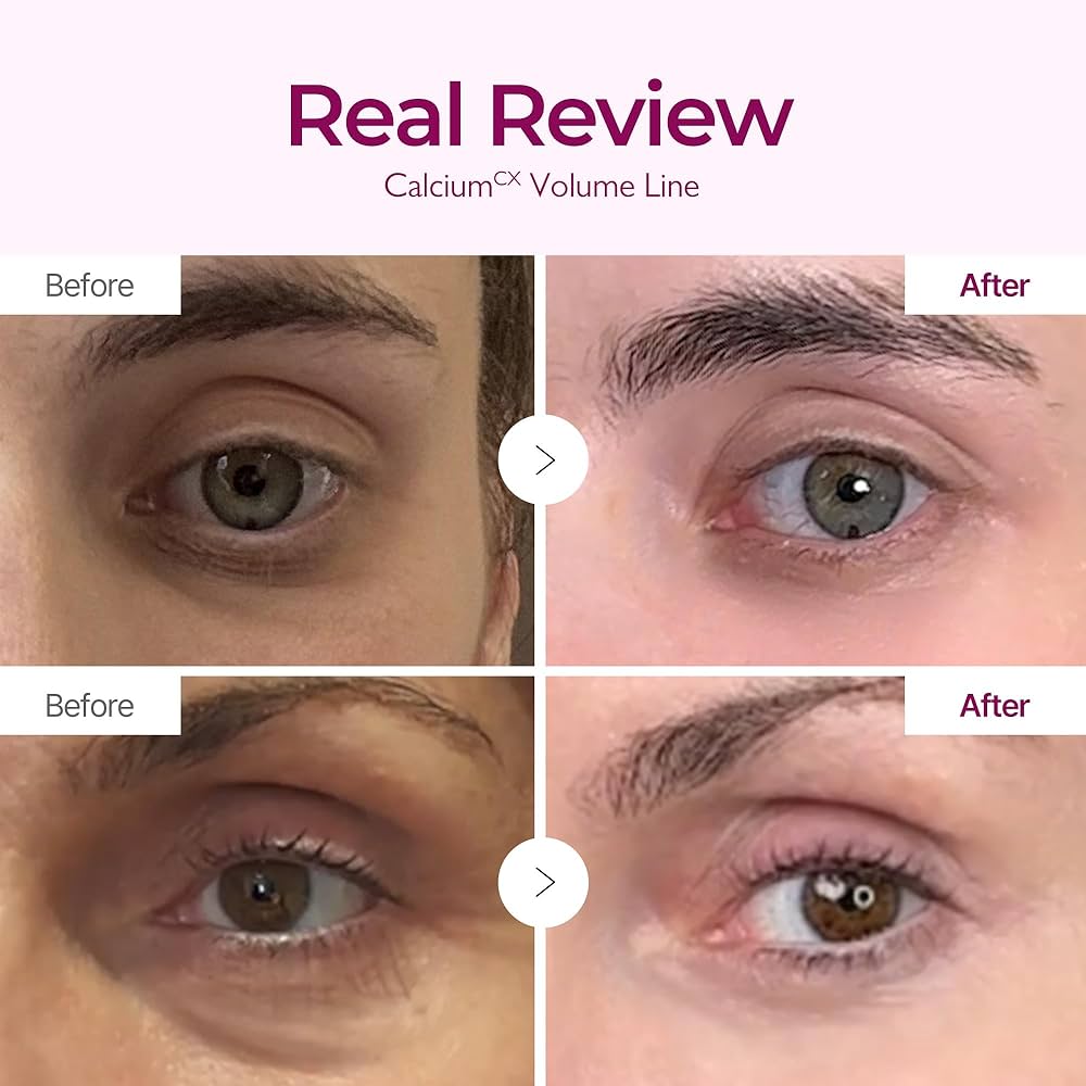 Cemenrete Calcium Volume Cream