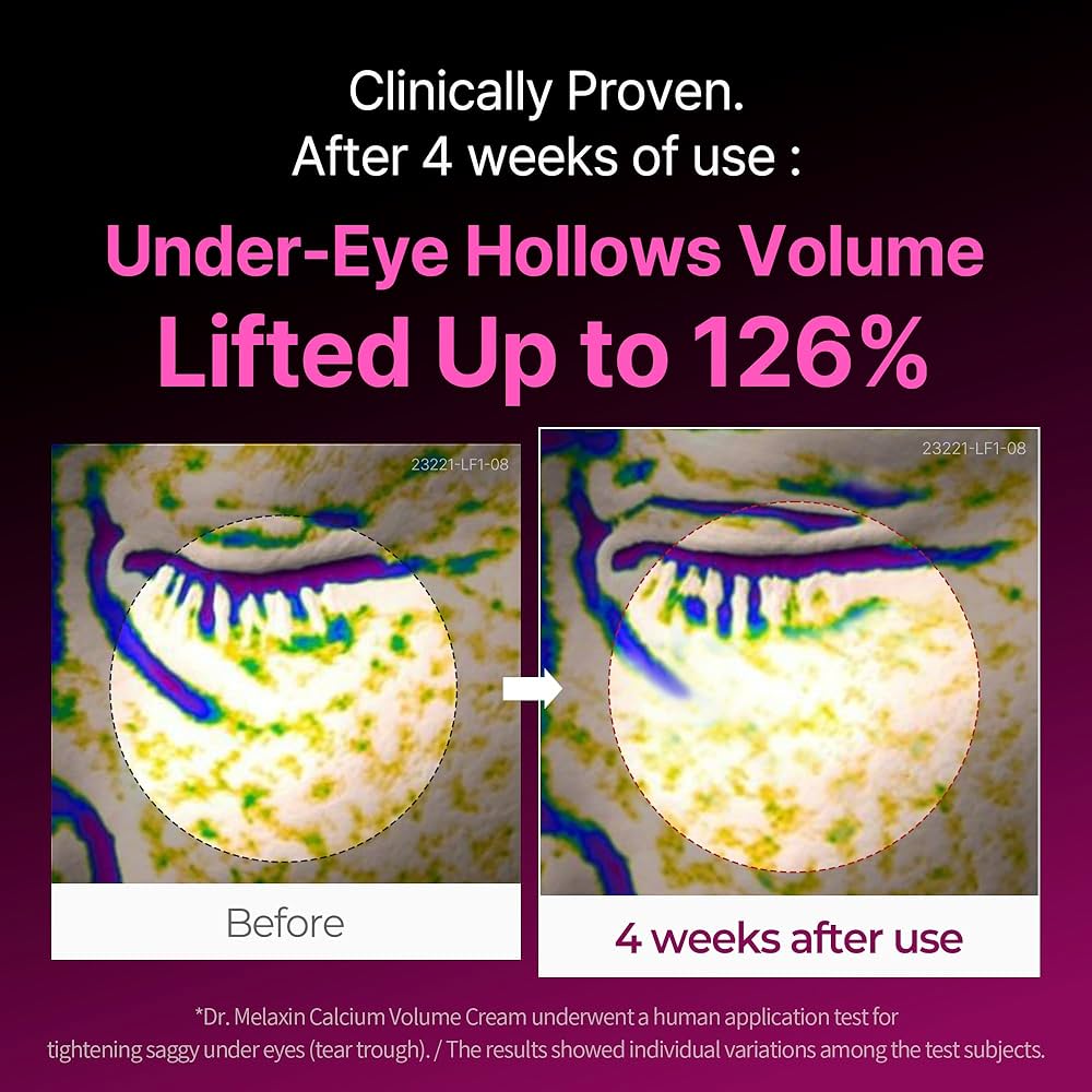 Cemenrete Calcium Volume Cream