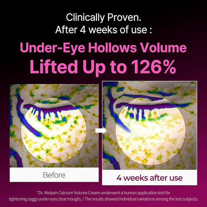 Cemenrete Calcium Volume Cream